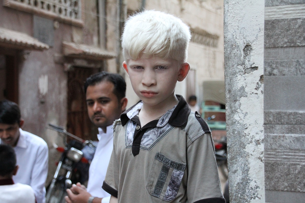 albino  white  asian free photo