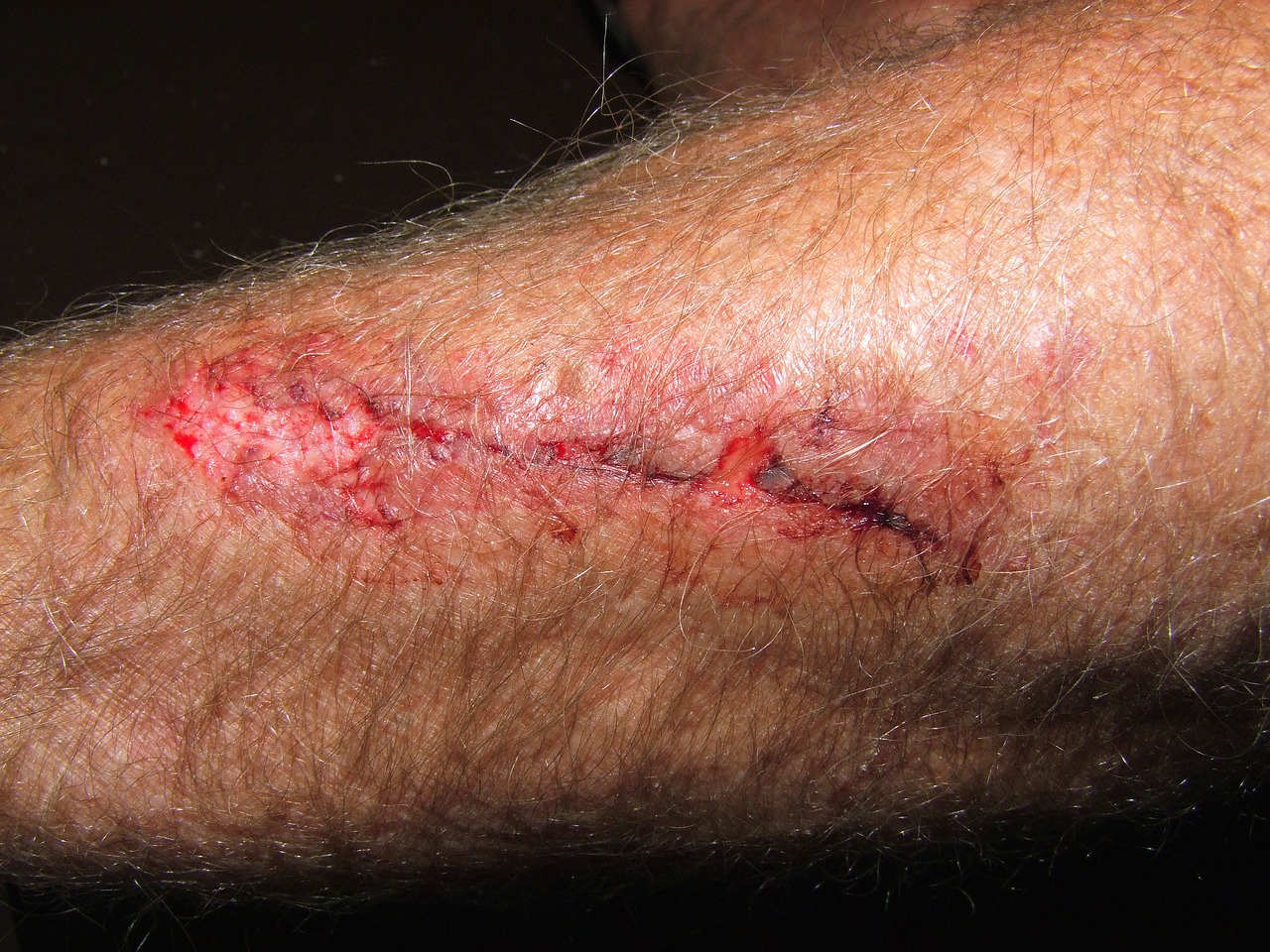 arm wound pain free photo
