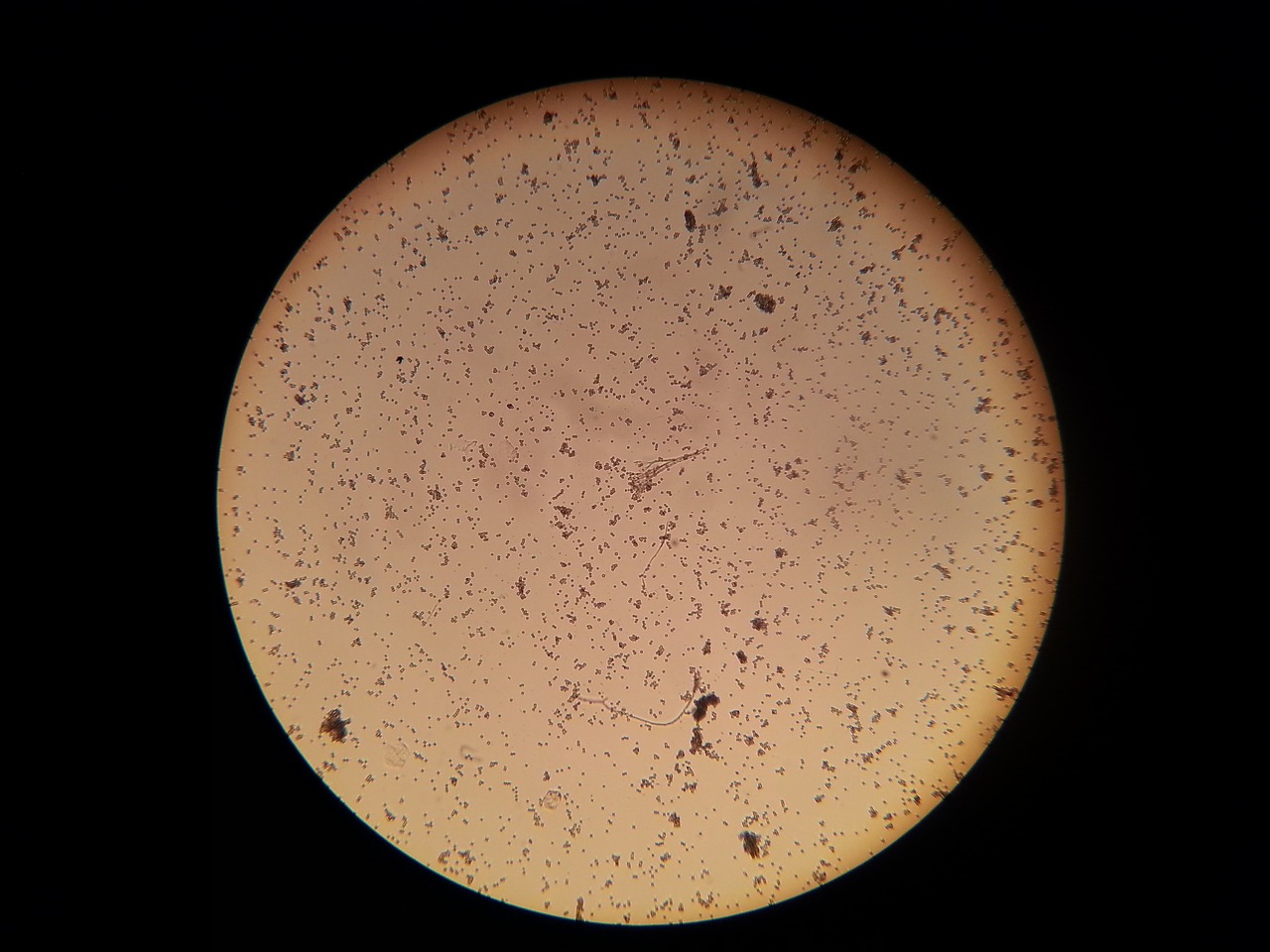 bacteria microscope microscopic image free photo