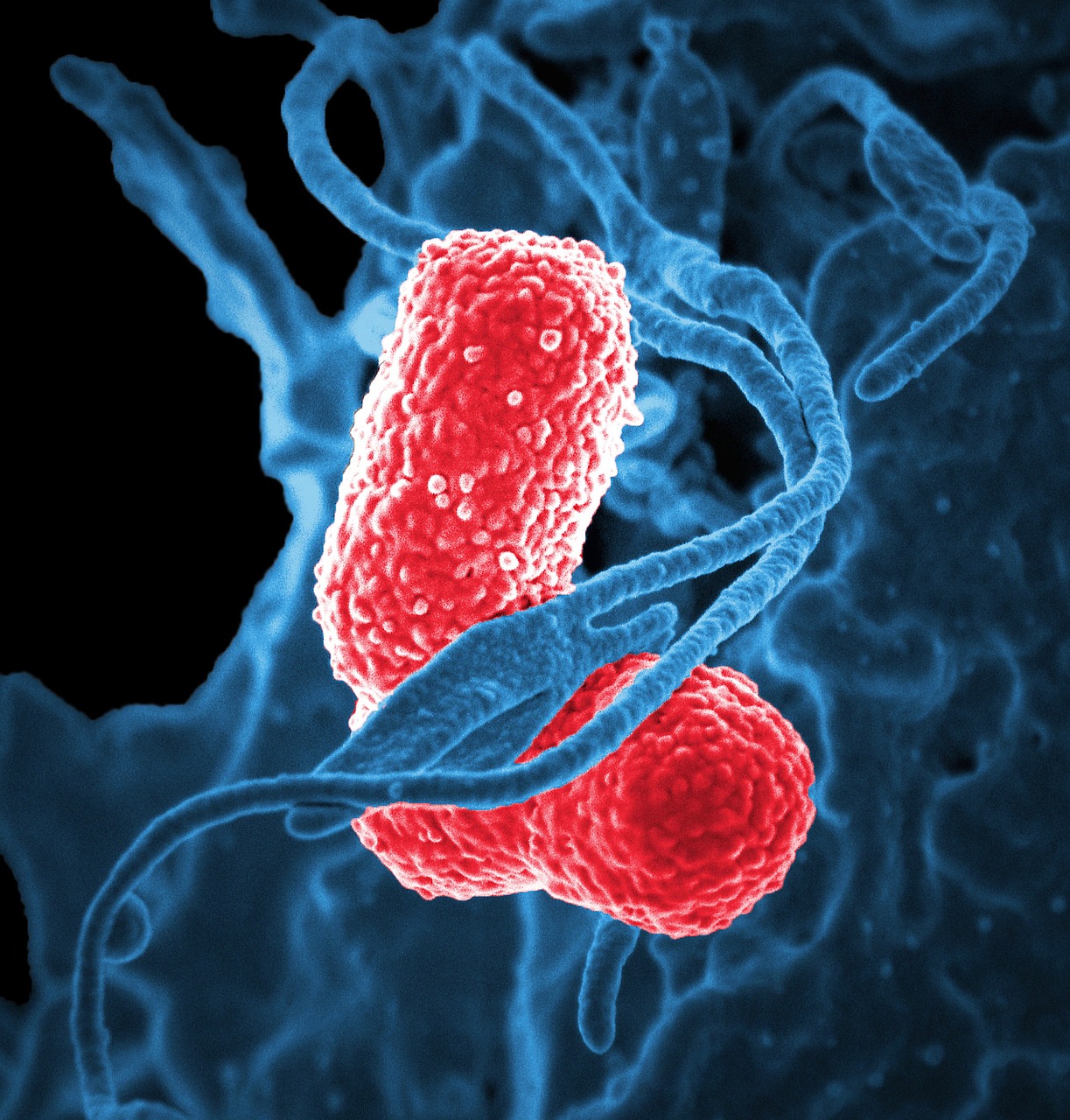 bacteria electron microscope klebsiella pneumoniae free photo