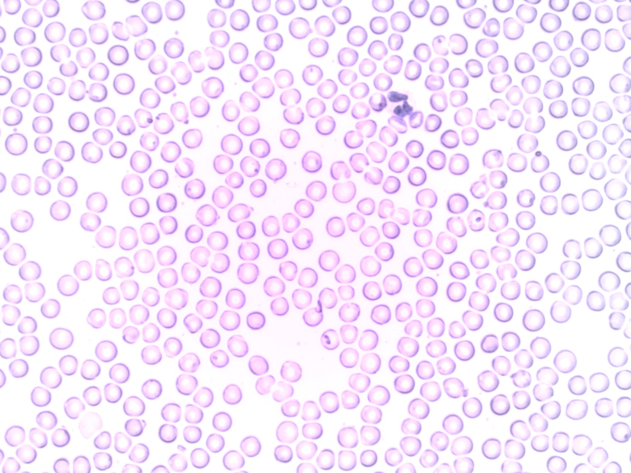 blood neutrophil segmented neutrophil free photo
