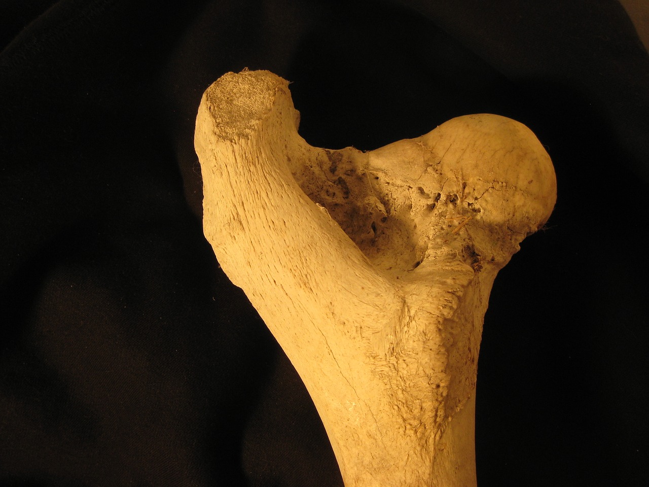 bone femur anatomy free photo
