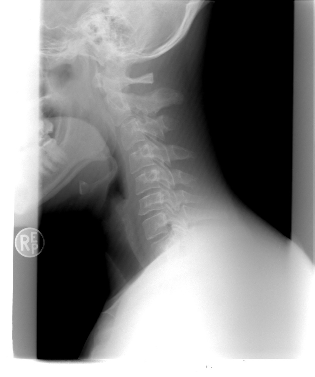 cervical spine xray patient free photo