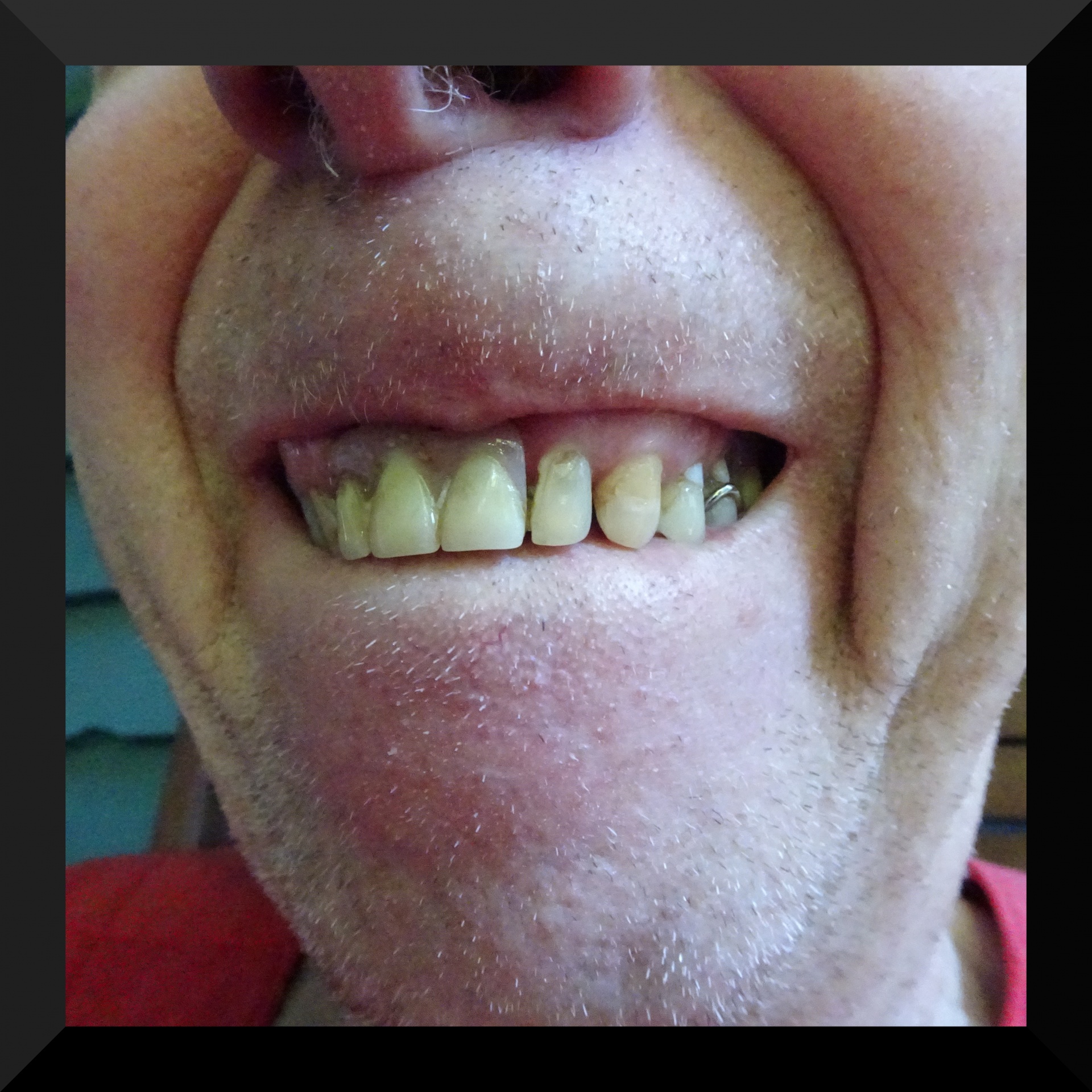 man face teeth free photo