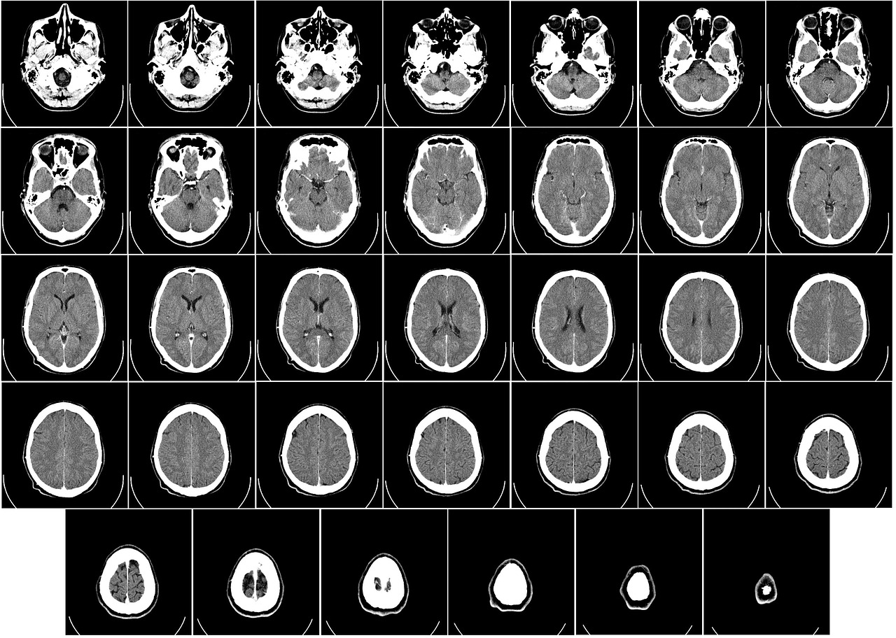 computer tomography ct radiography free photo