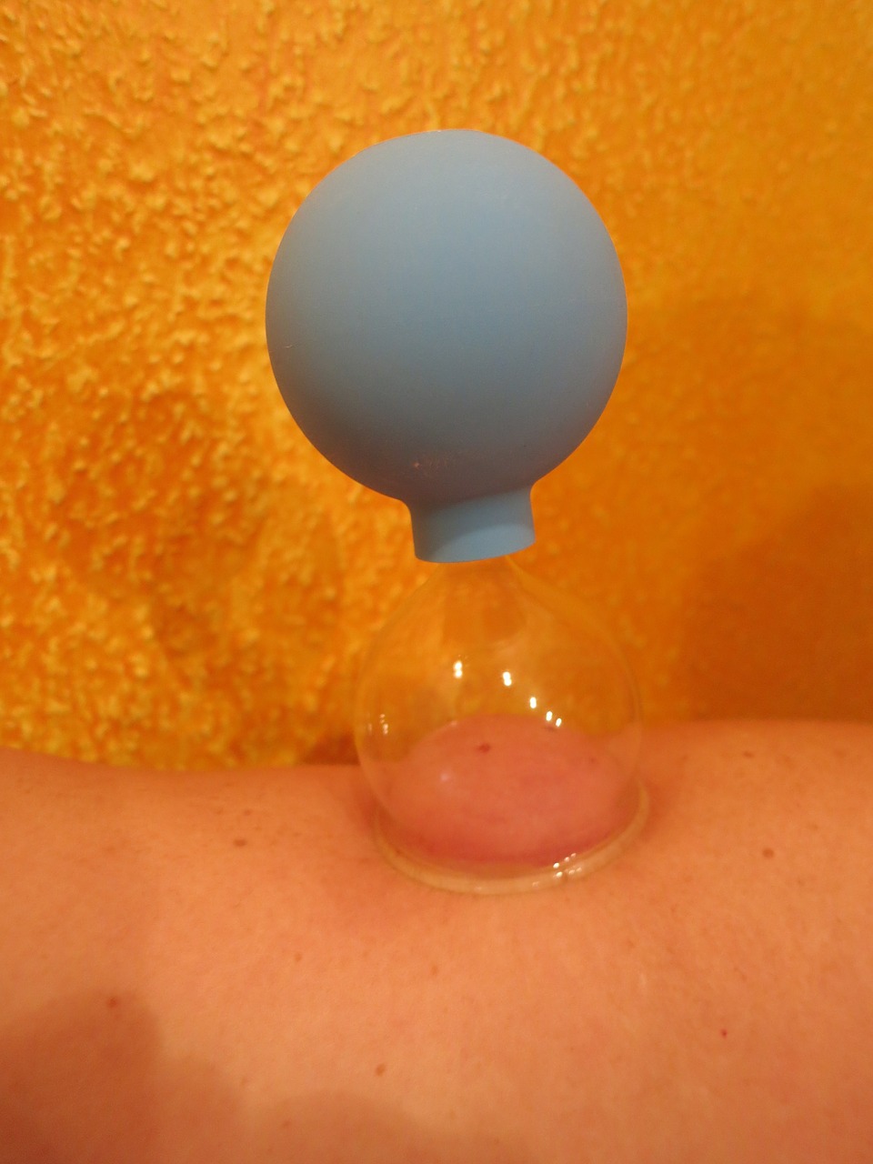 cupping massage cupping massage free photo