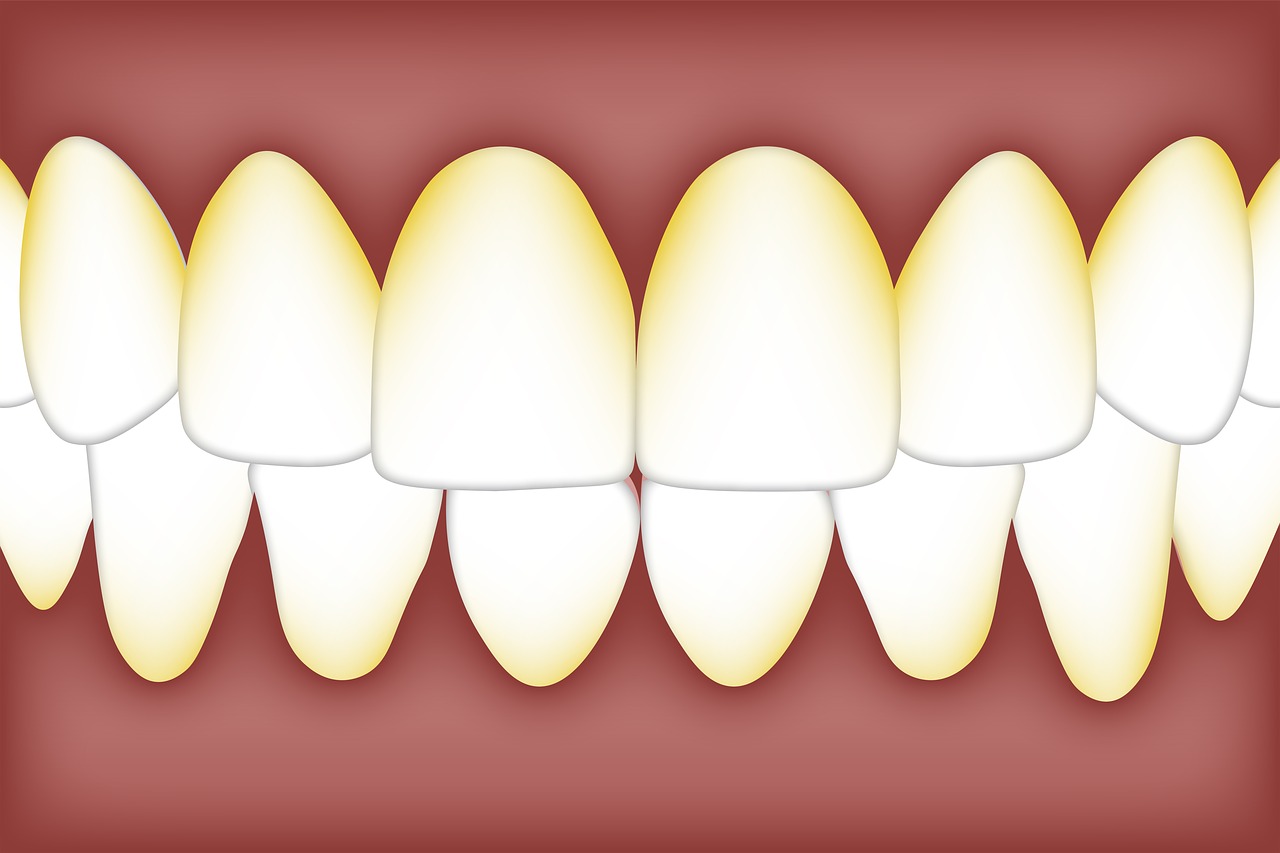 dental  plaque  biofilm free photo