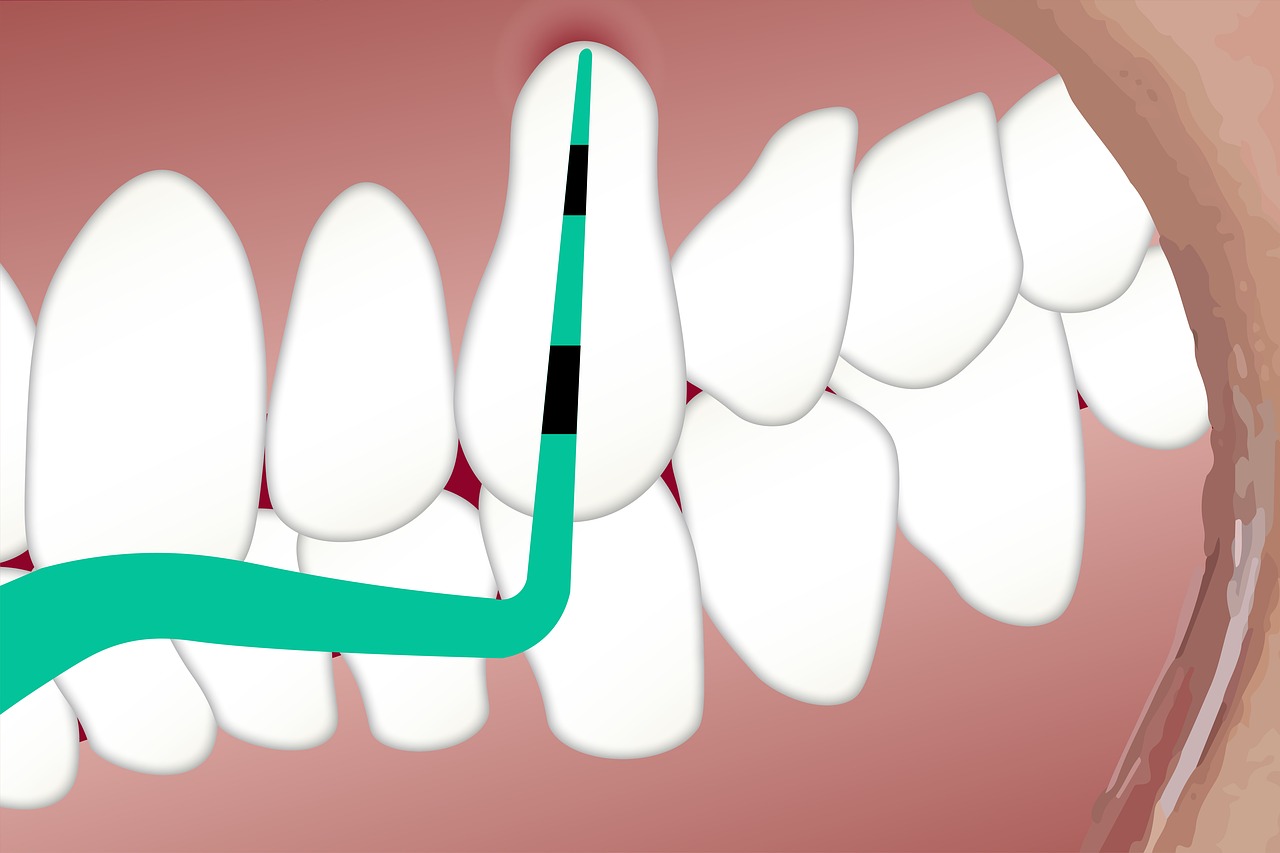 dental  pocket  depth free photo