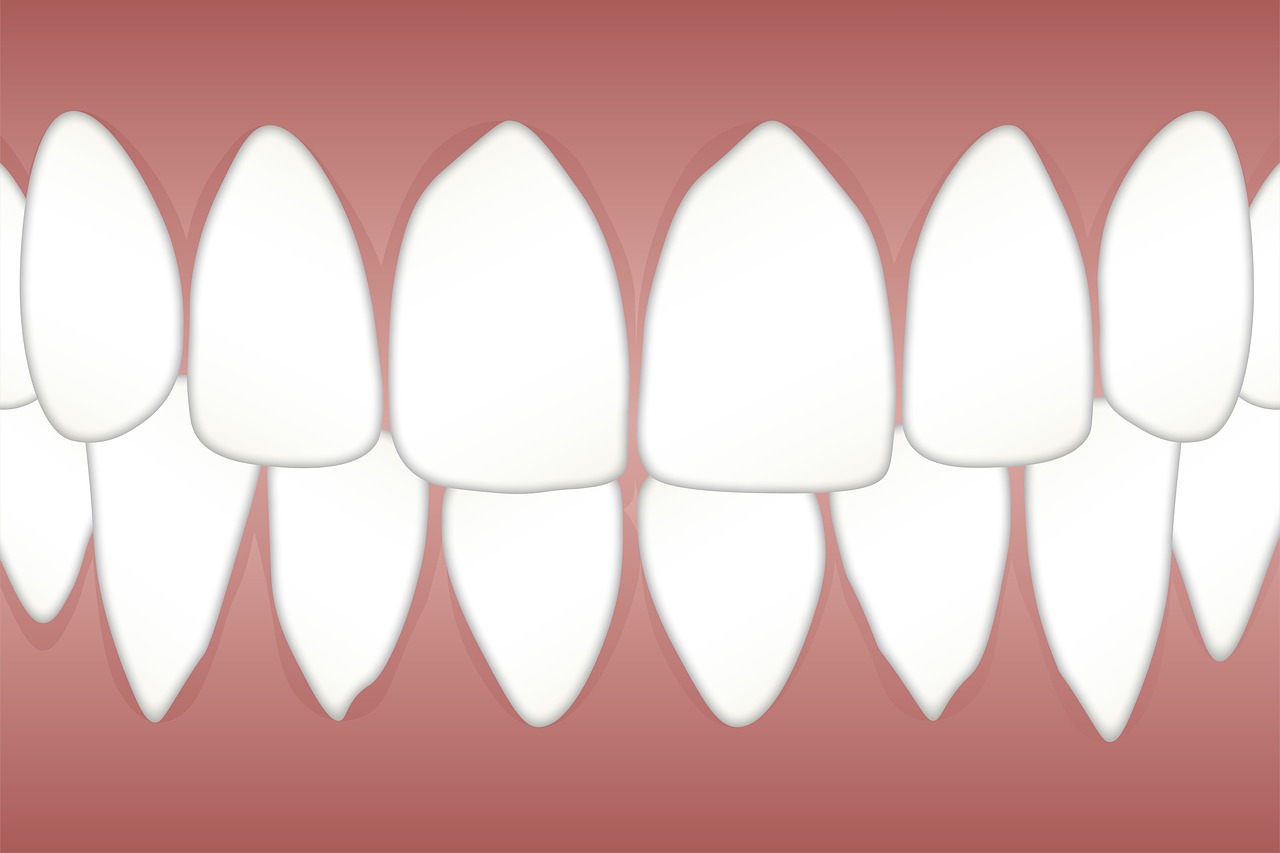 dental  periodontal  disease free photo