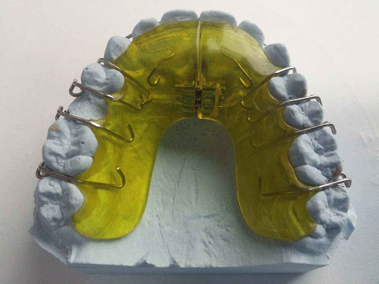 dental braces dentist orthodontics free photo