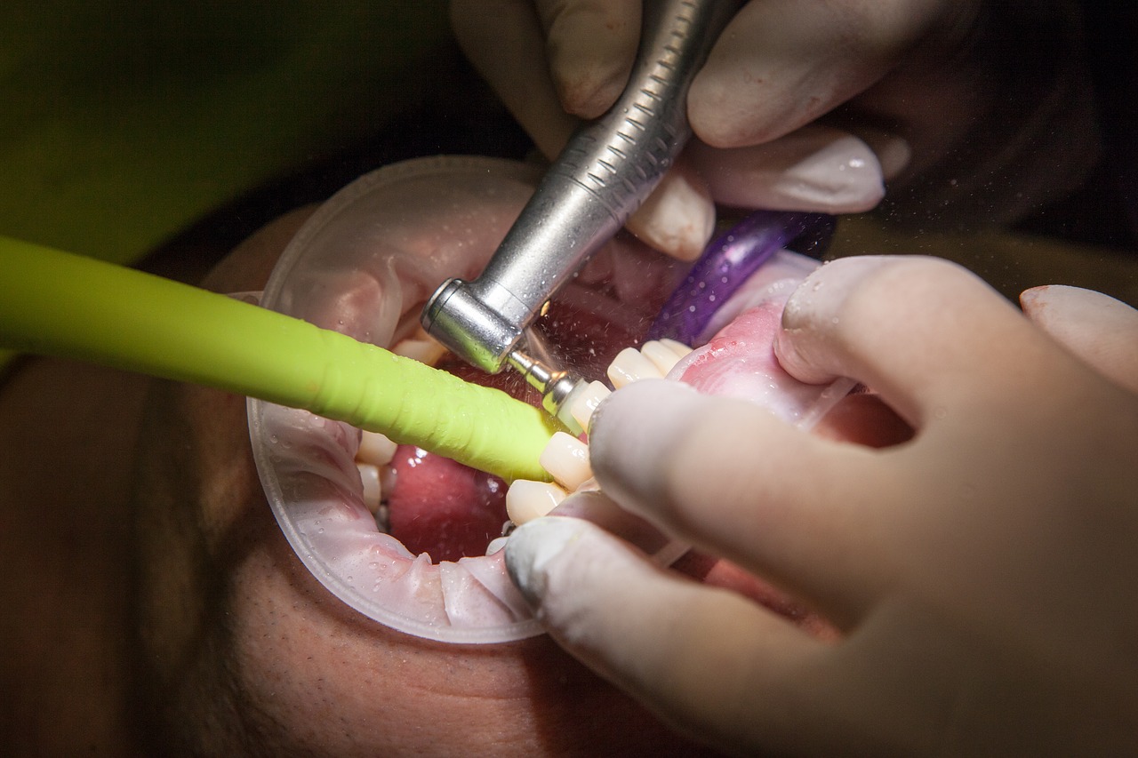 dentist grind facet free photo