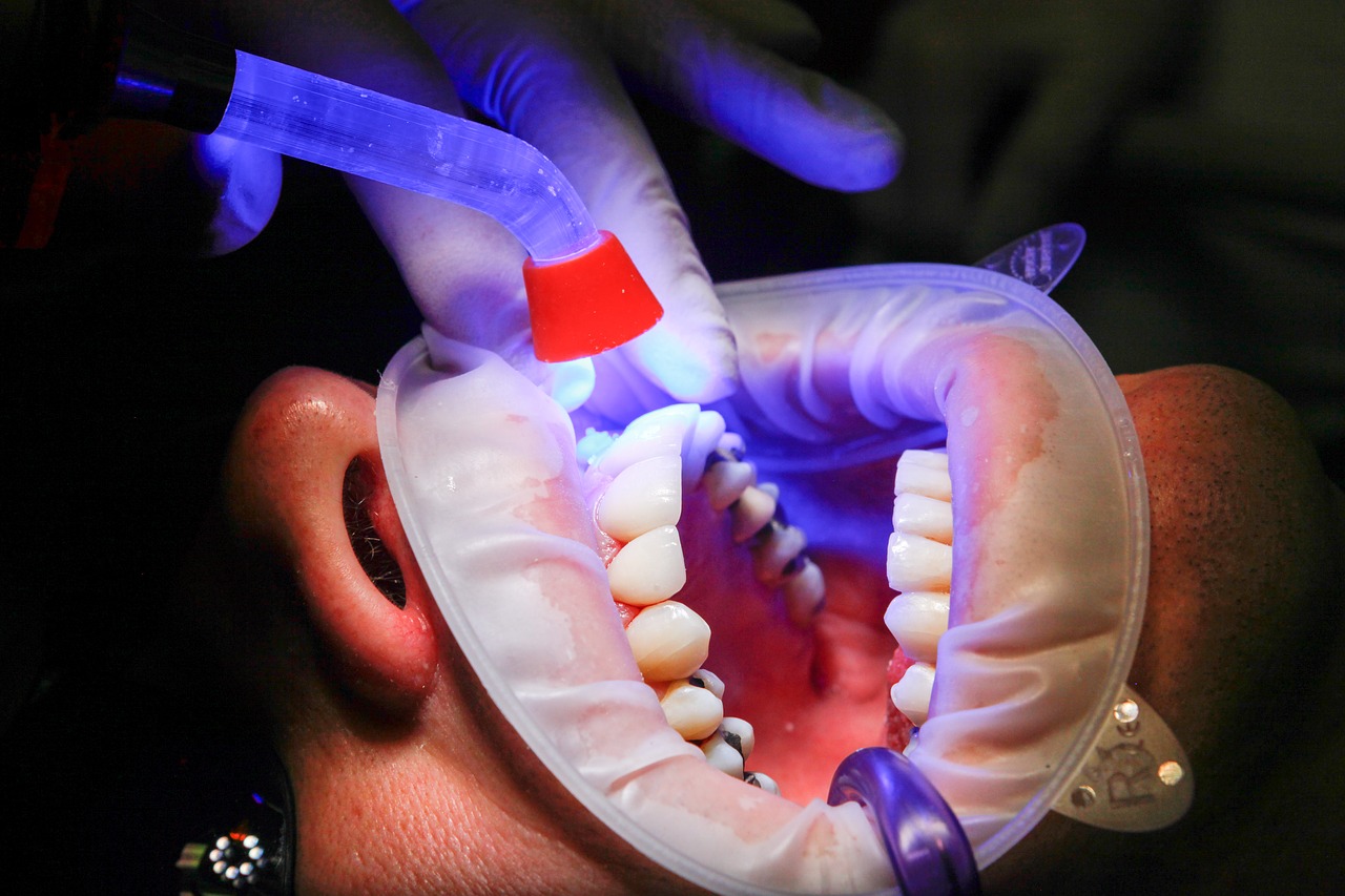 dentist facet uv light free photo