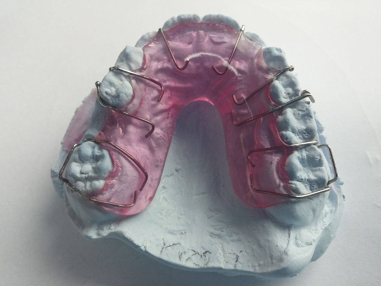 dentist orthodontics dental rail free photo