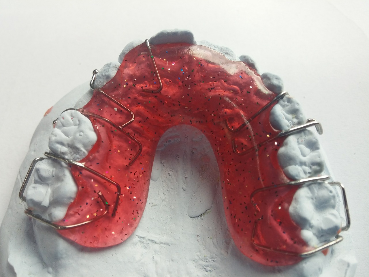 dentist orthodontics dental rail free photo