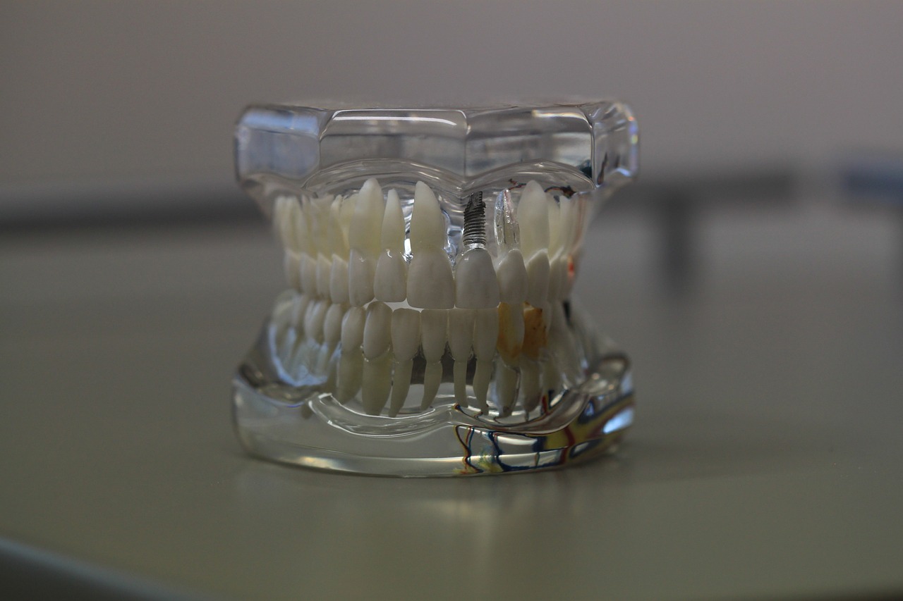 dentistry dentals teeth free photo