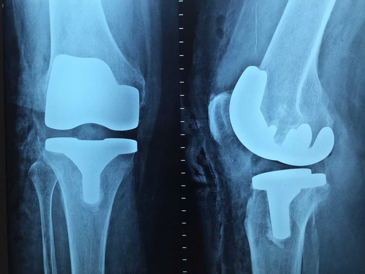 doctor orthopedics x-ray free photo