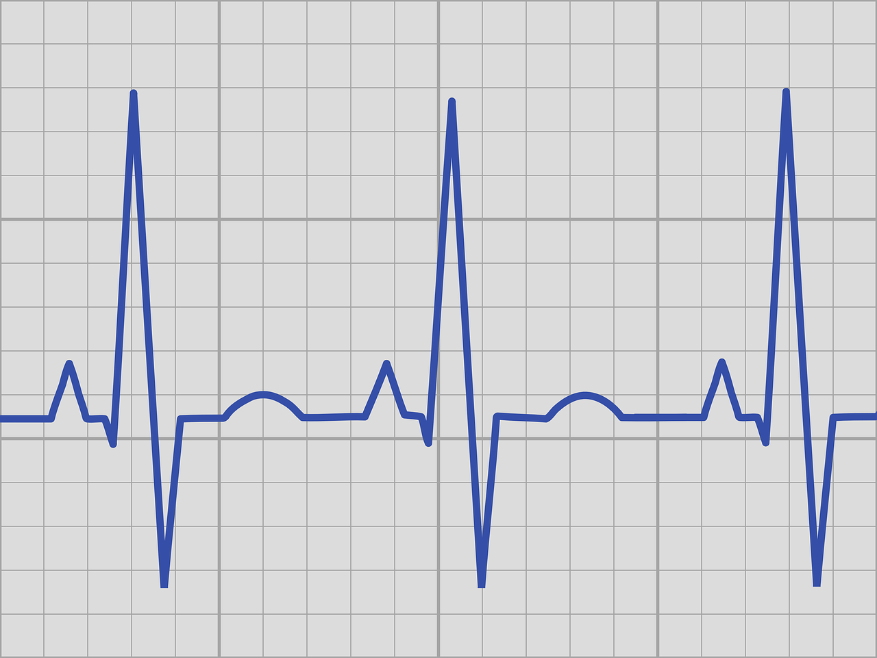 ecg  echo kardiogram  rhythm free photo