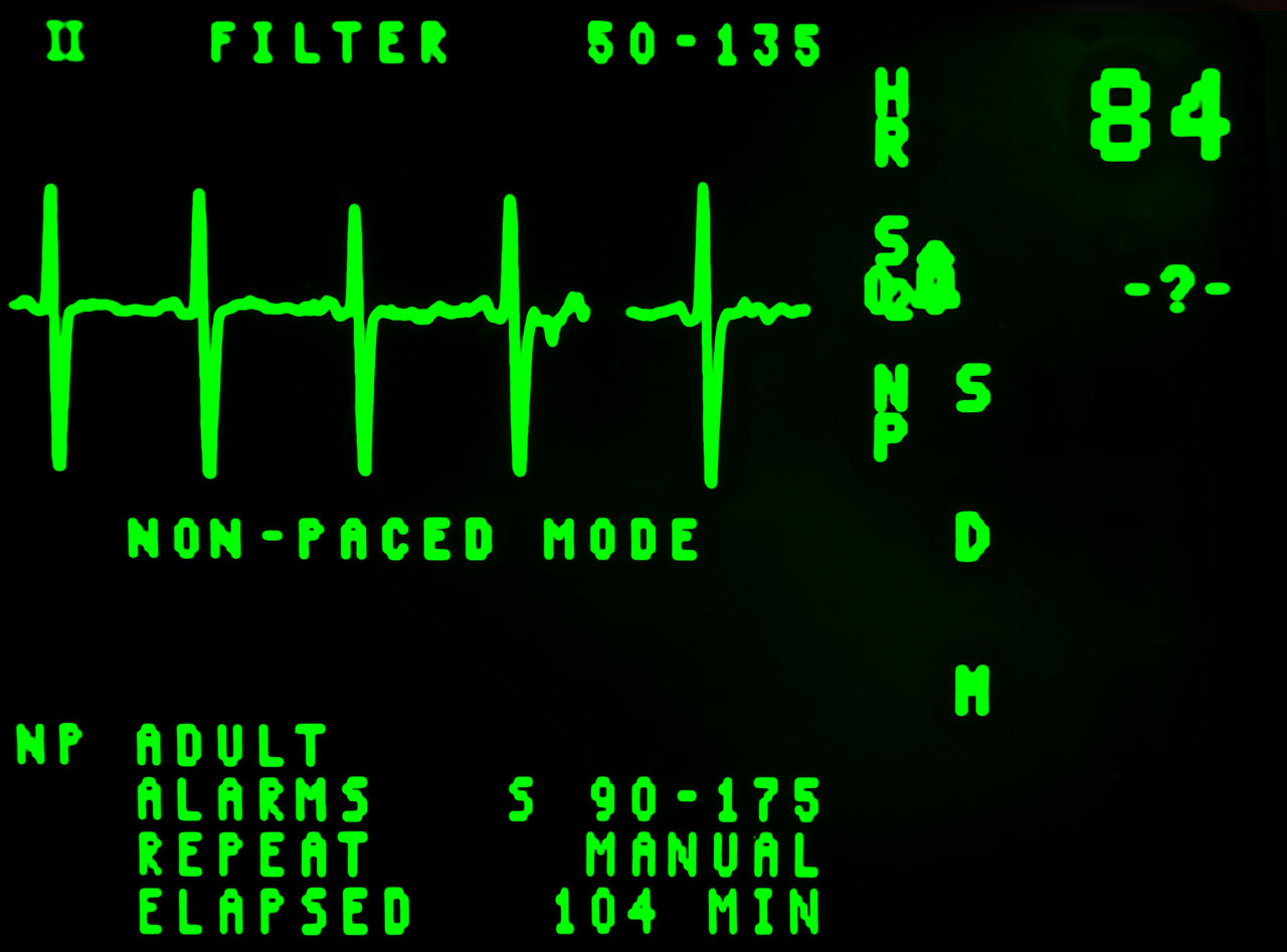 electrocardiogram beat cardiology free photo