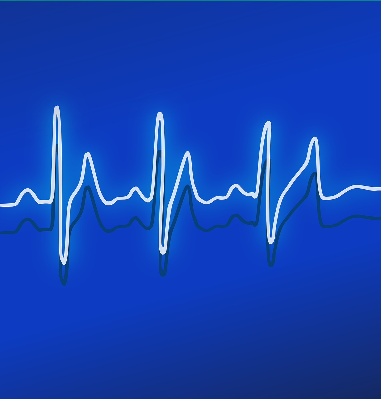 ekg heartbeat frequency free photo