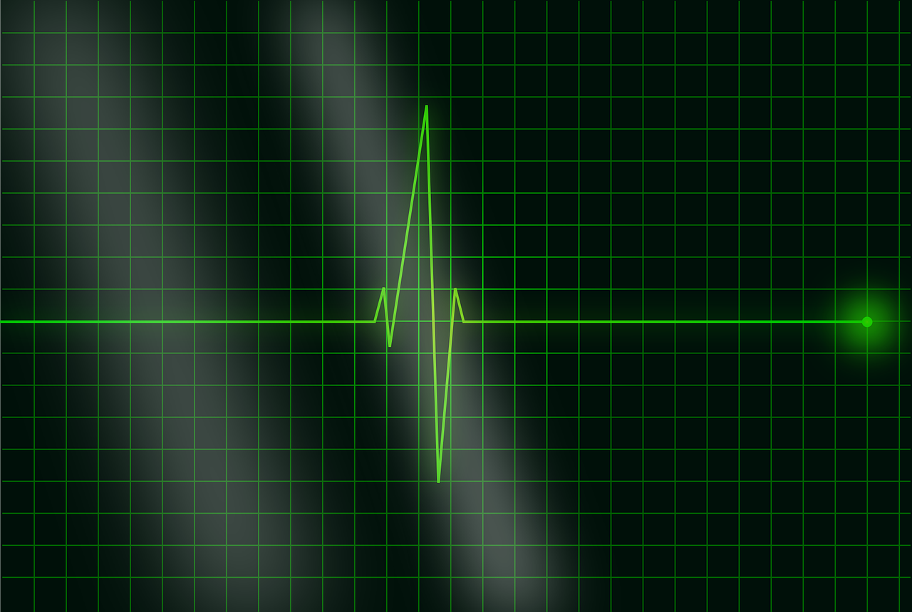 electrocardiogram ecg heartbeat free photo