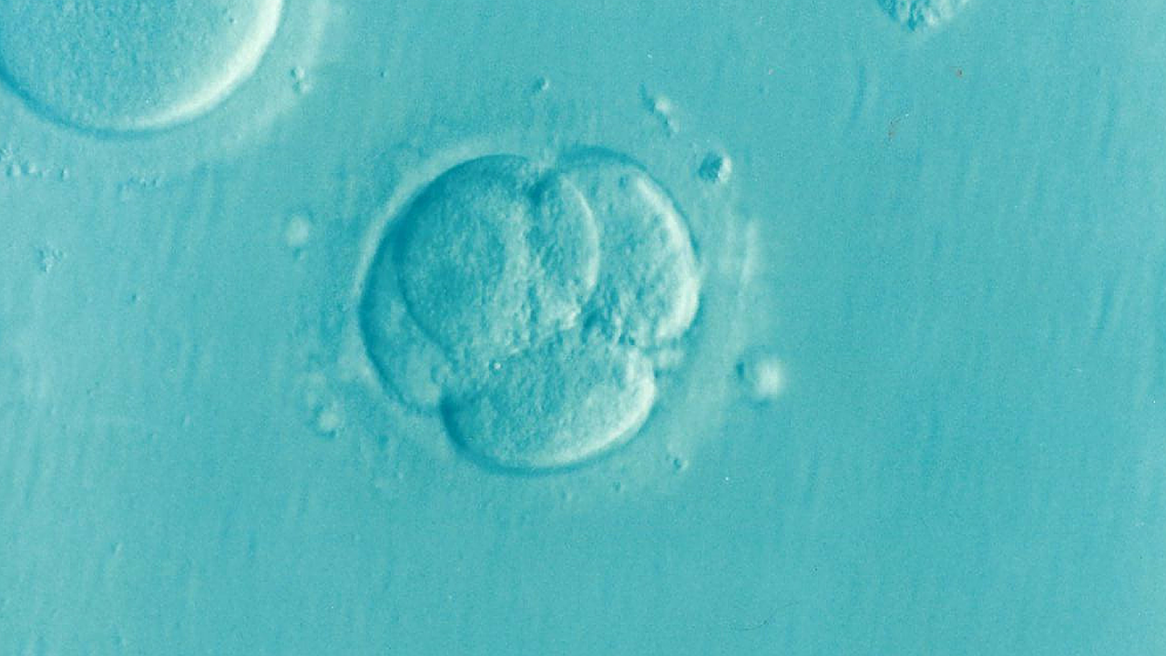 embryo ivf icsi free photo