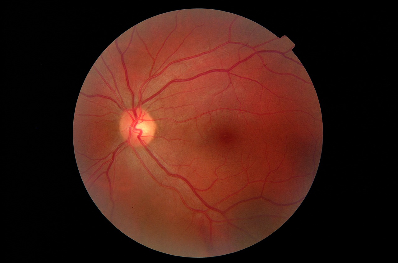 eye fundus close free photo