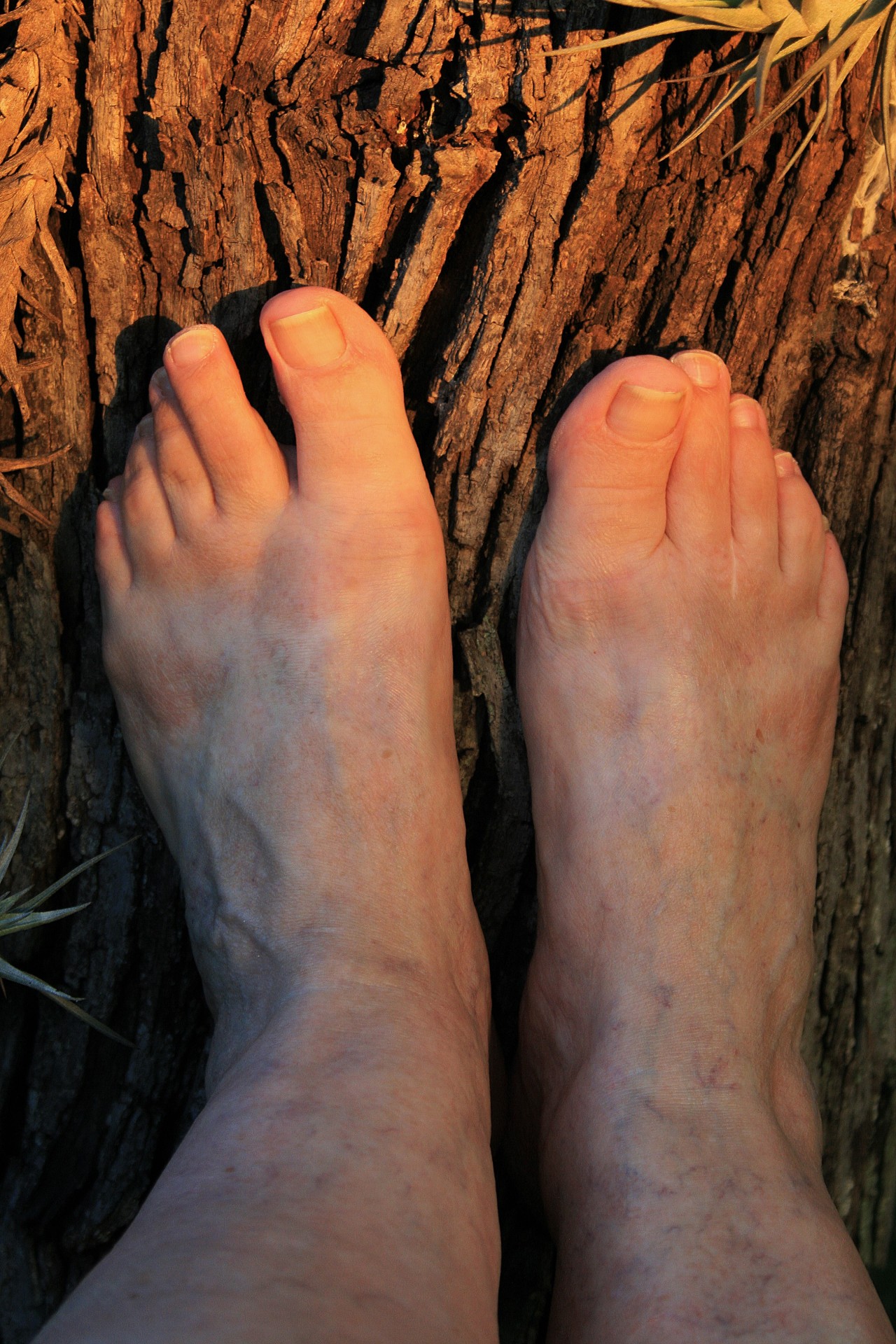 feet tree surface free photo