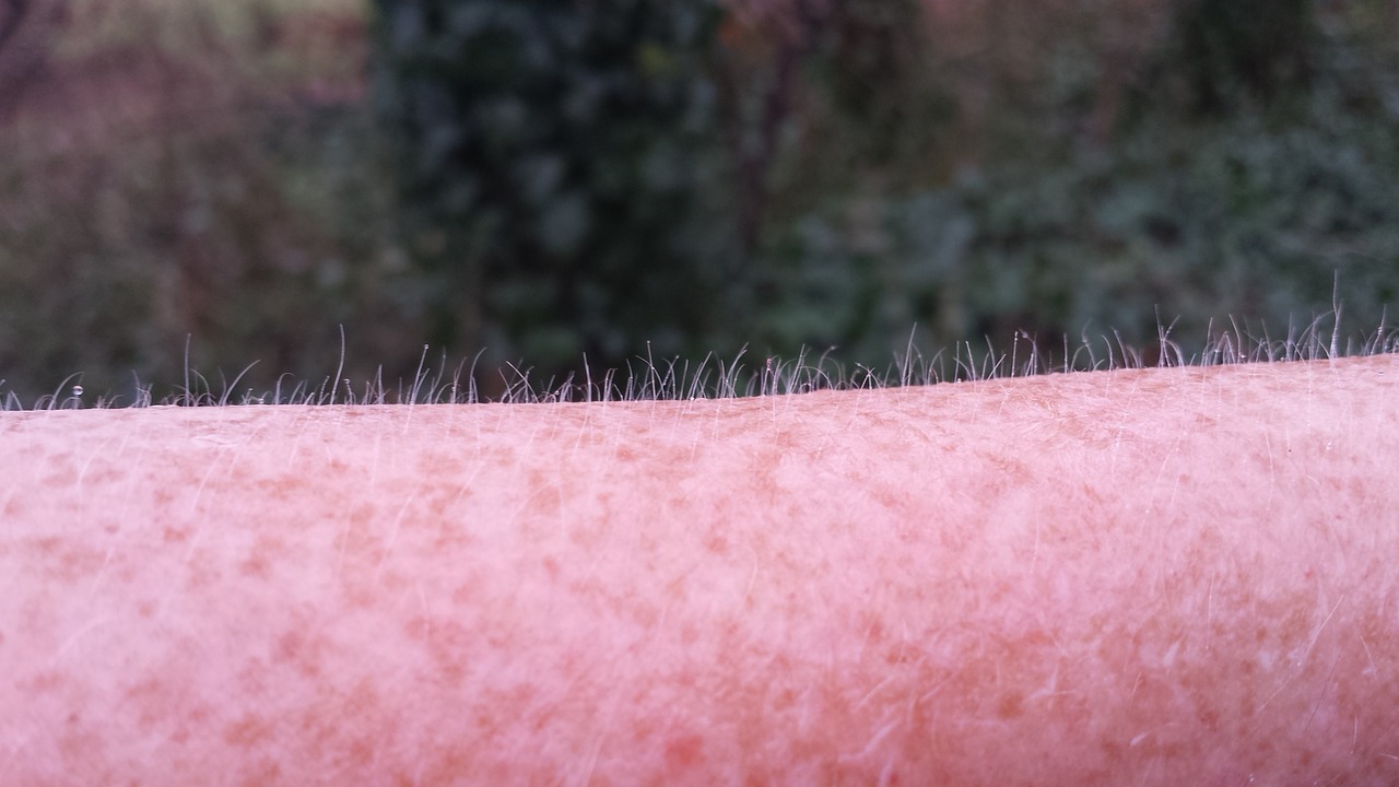 goose bumps freckles cold free photo