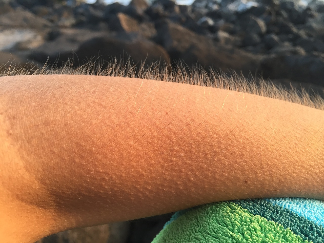 goosebumps cold arm free photo