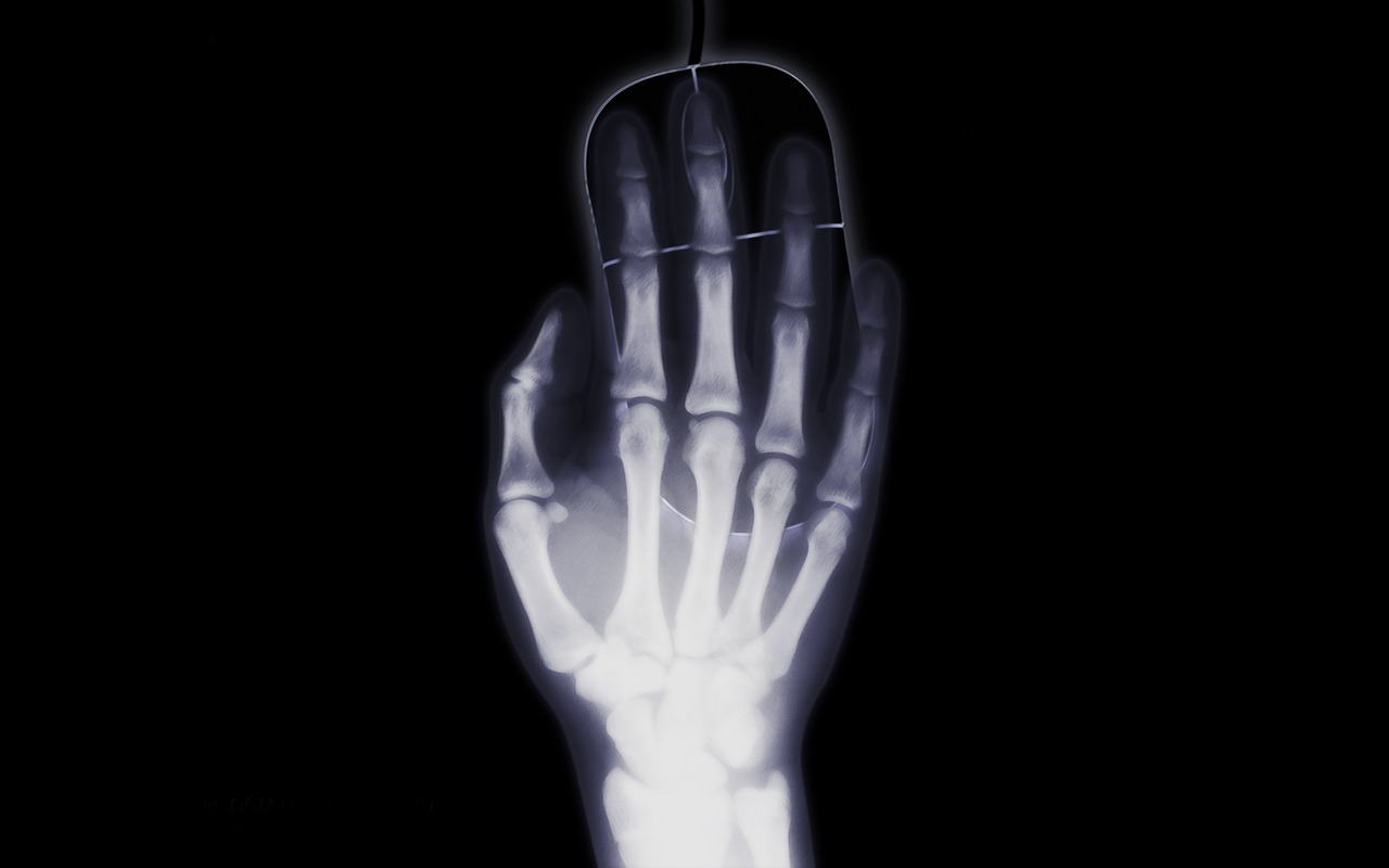 hand x ray x ray image free photo