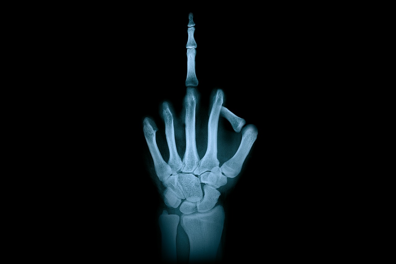 hand middle finger x-ray radiation free photo