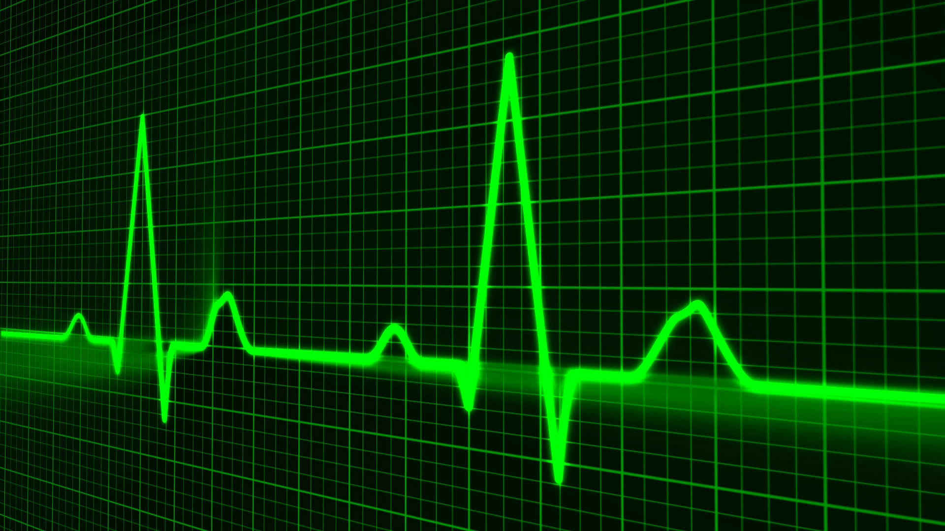 pulse trace healthcare medicine heartbeat free photo