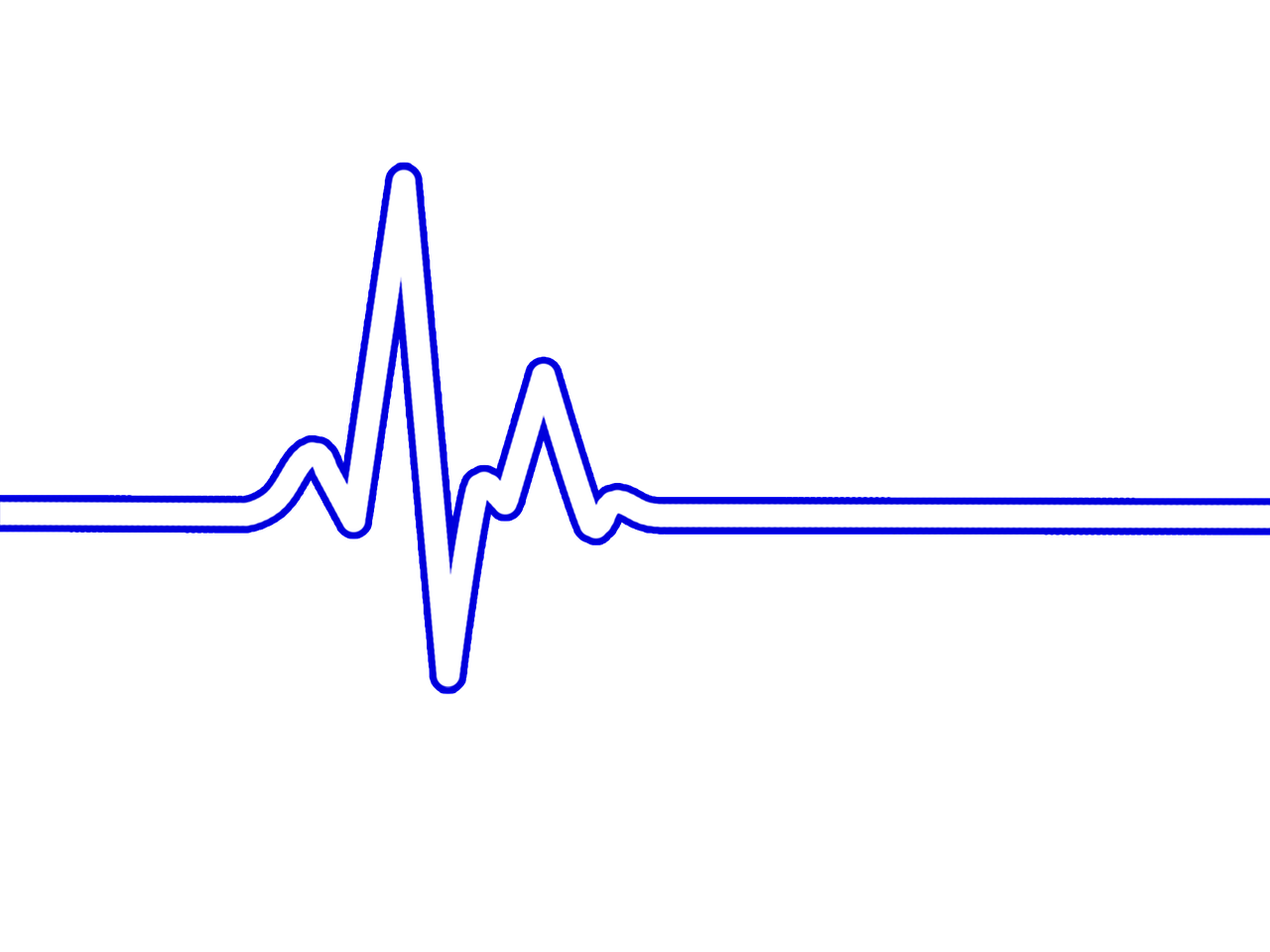 heart rate bpm ecg free photo