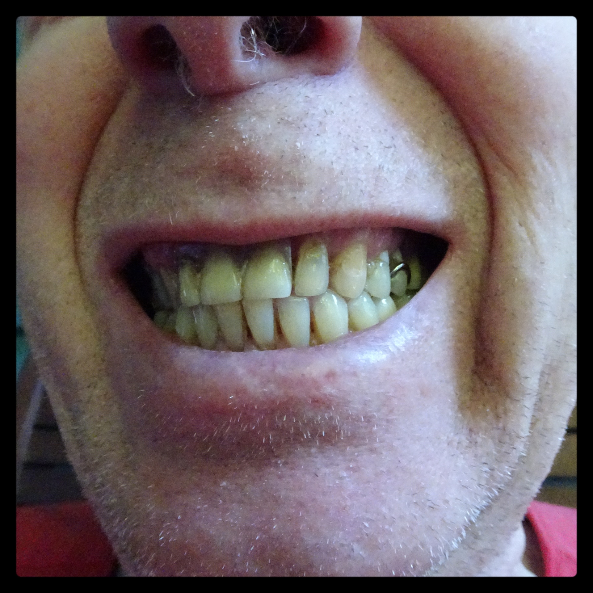 man showing teeth free photo