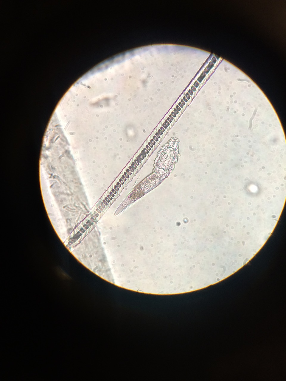 microscope mites demodex free photo