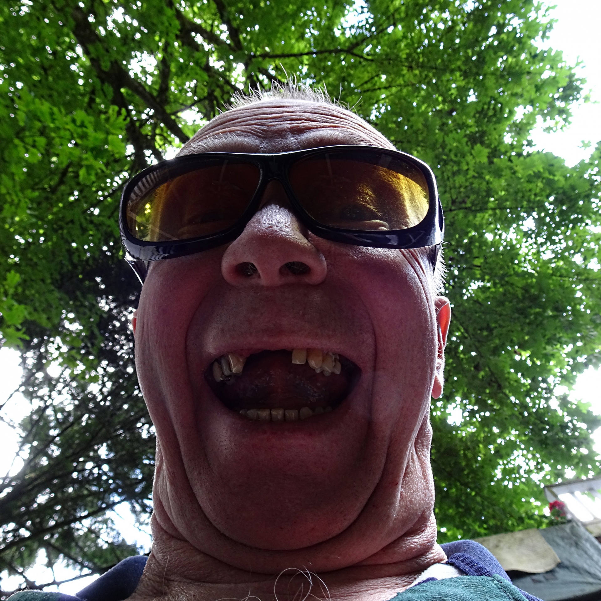 selfie missing teeth free photo