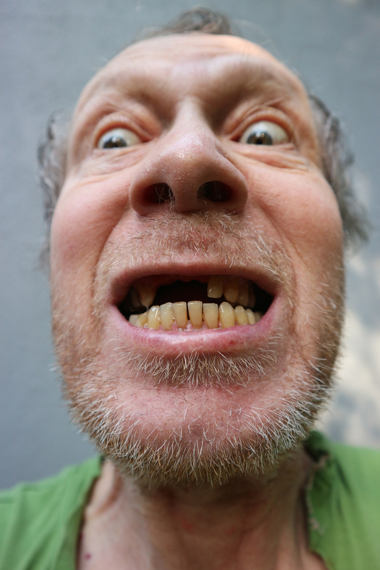 Как выглядит человек без зубов фото
