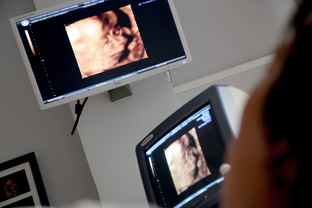 monitor ultrasound medical consultation free photo
