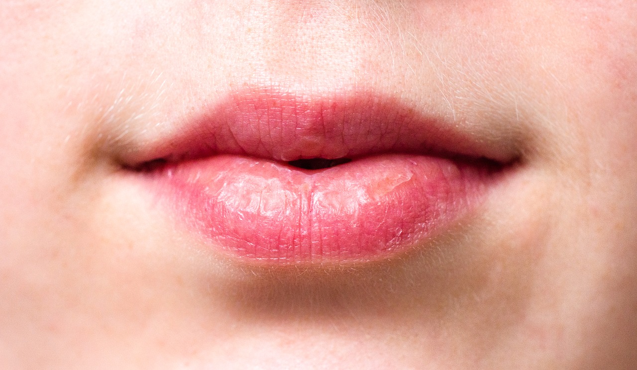 mouth lips dry lips free photo