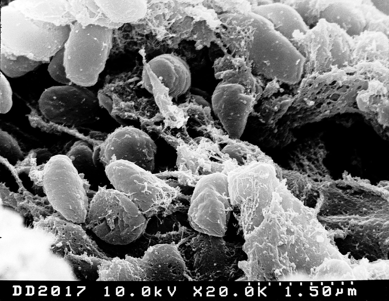 pestis bacteria bubonic plague free photo