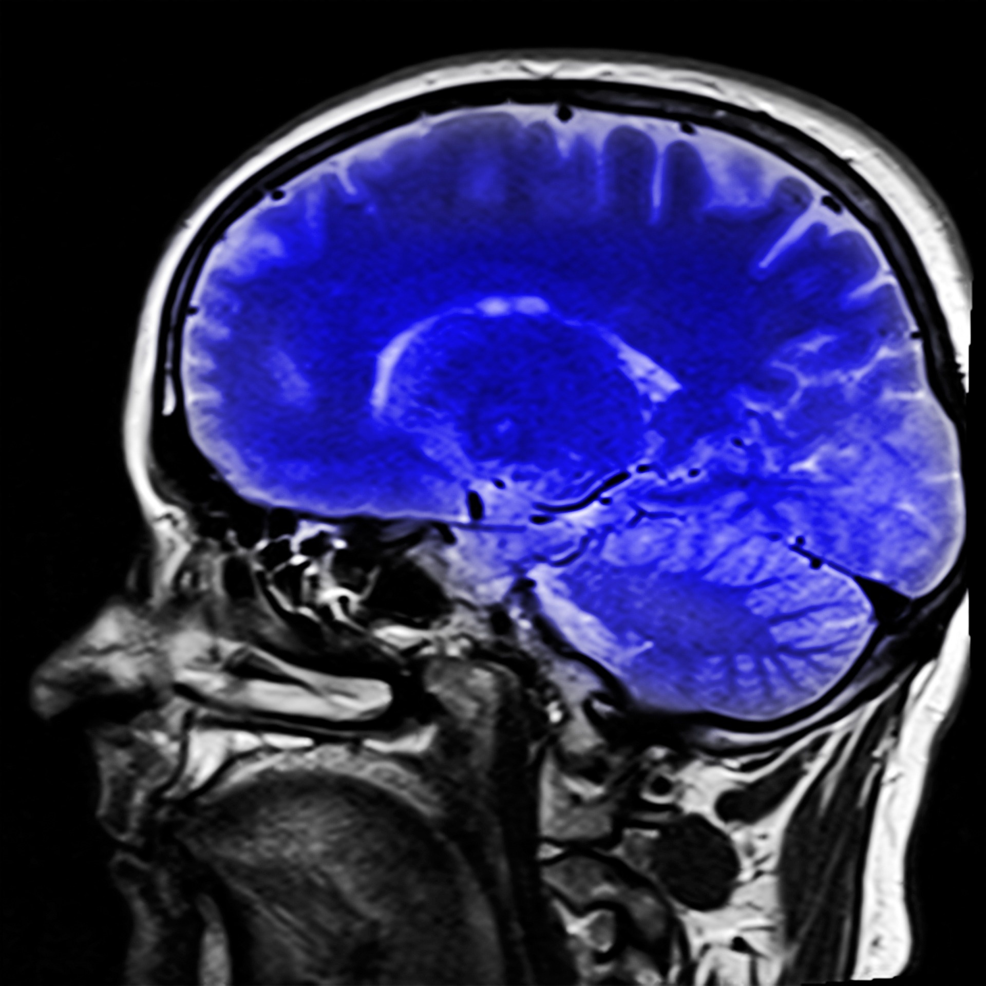 head magnetic resonance imaging mri free photo