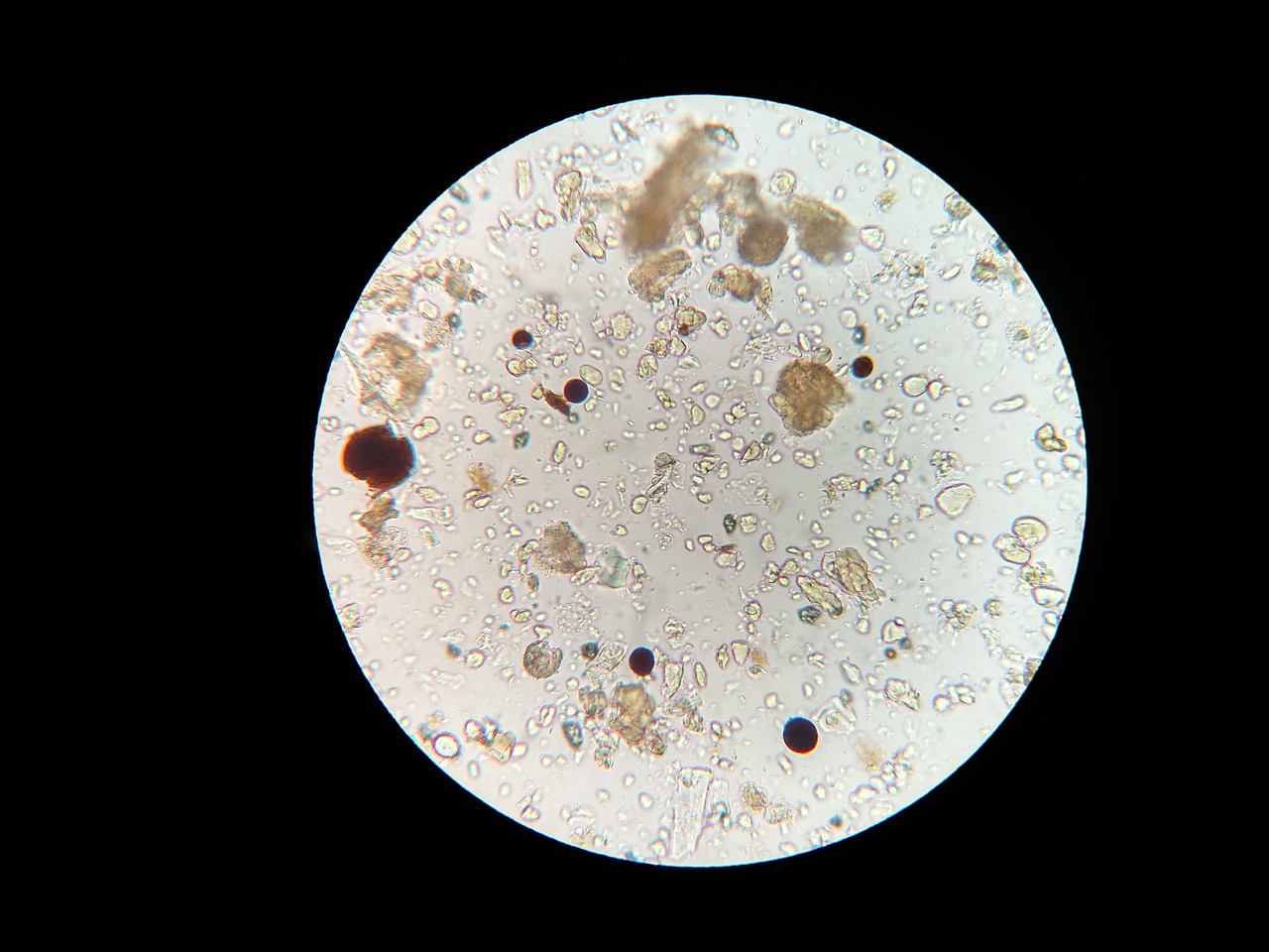 soil microbes microscope soil sample free photo