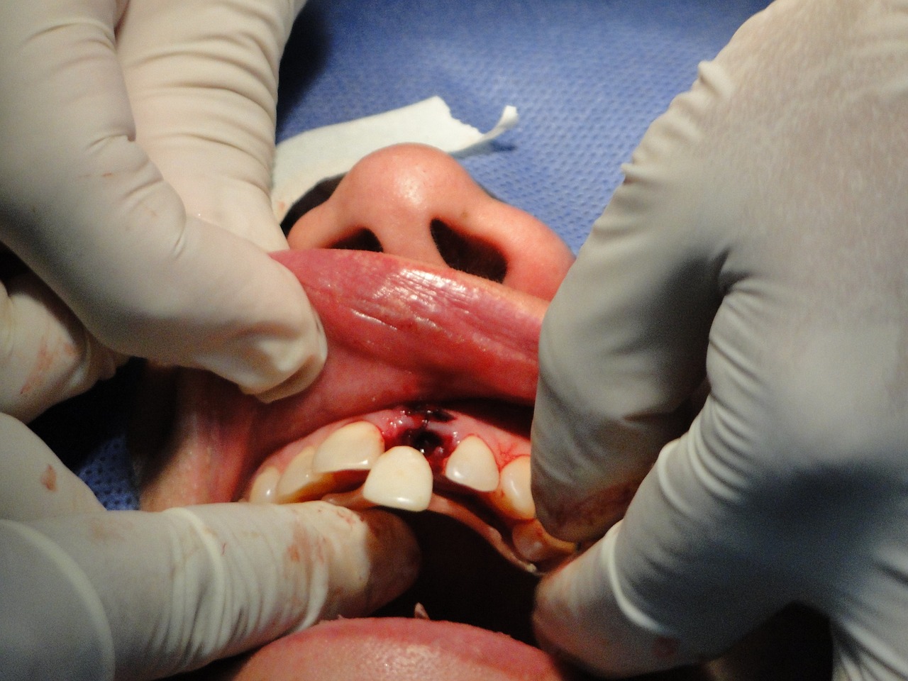 surgery teeth operation free photo