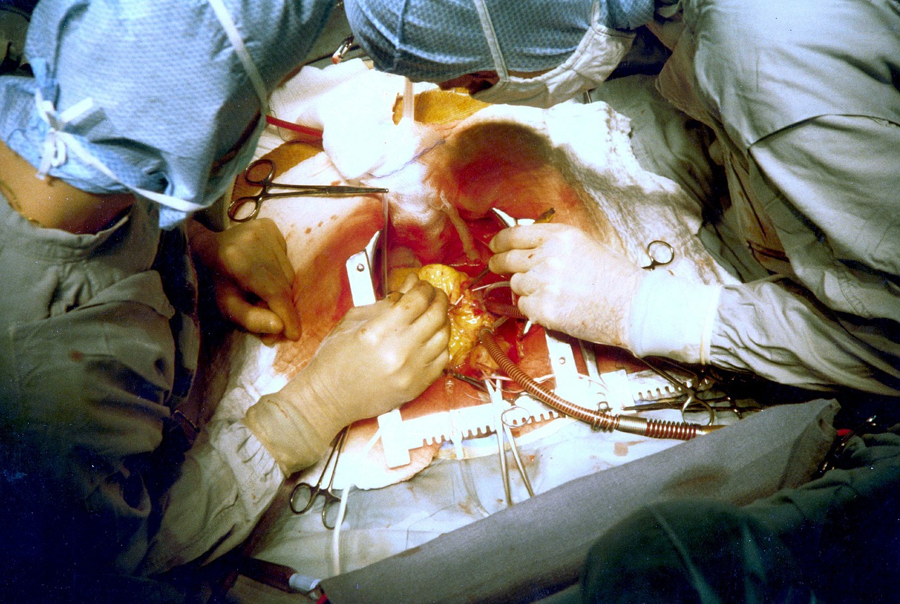 surgery coronary artery bypass operation free photo