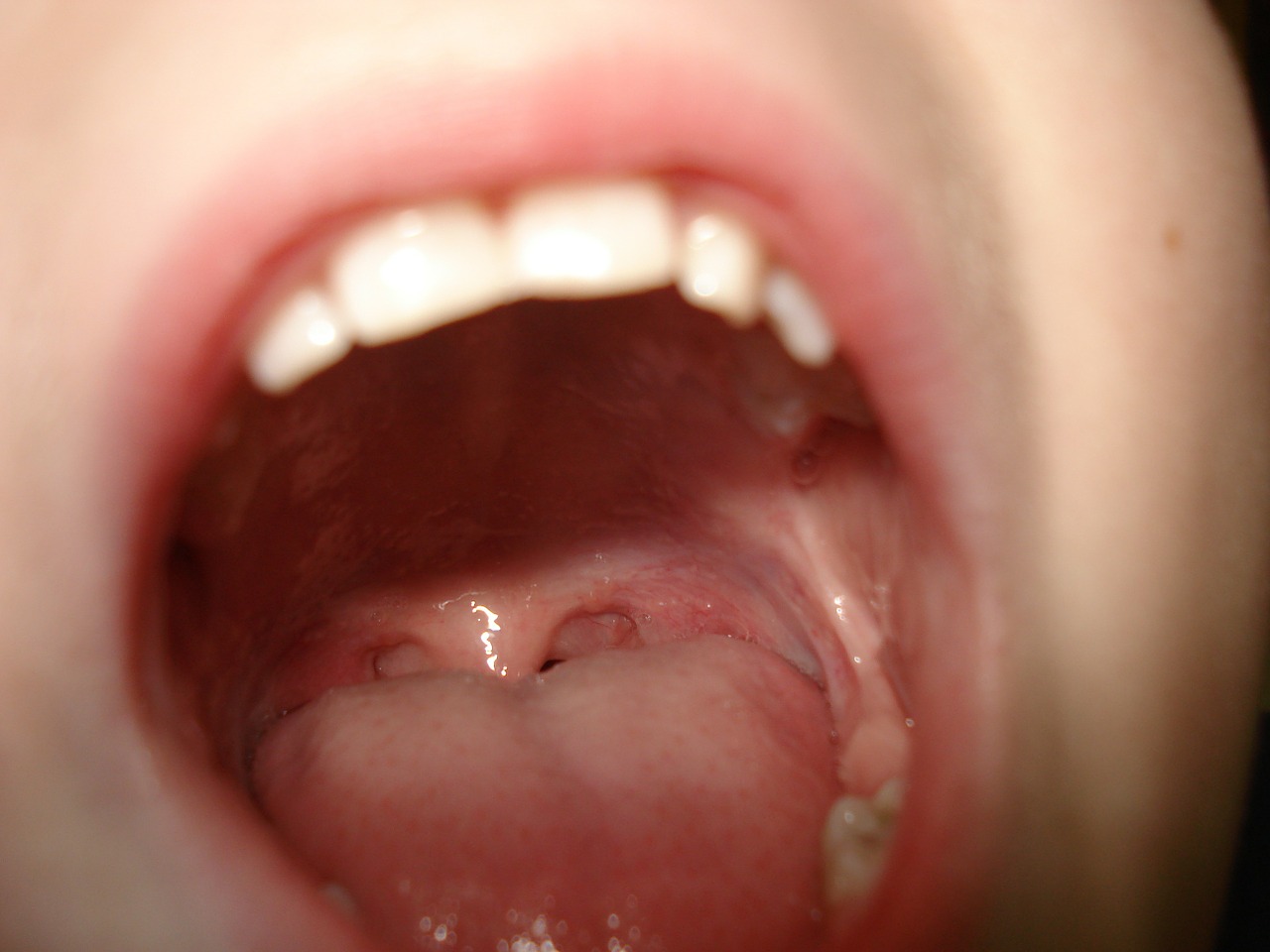 teeth mouth tongue free photo