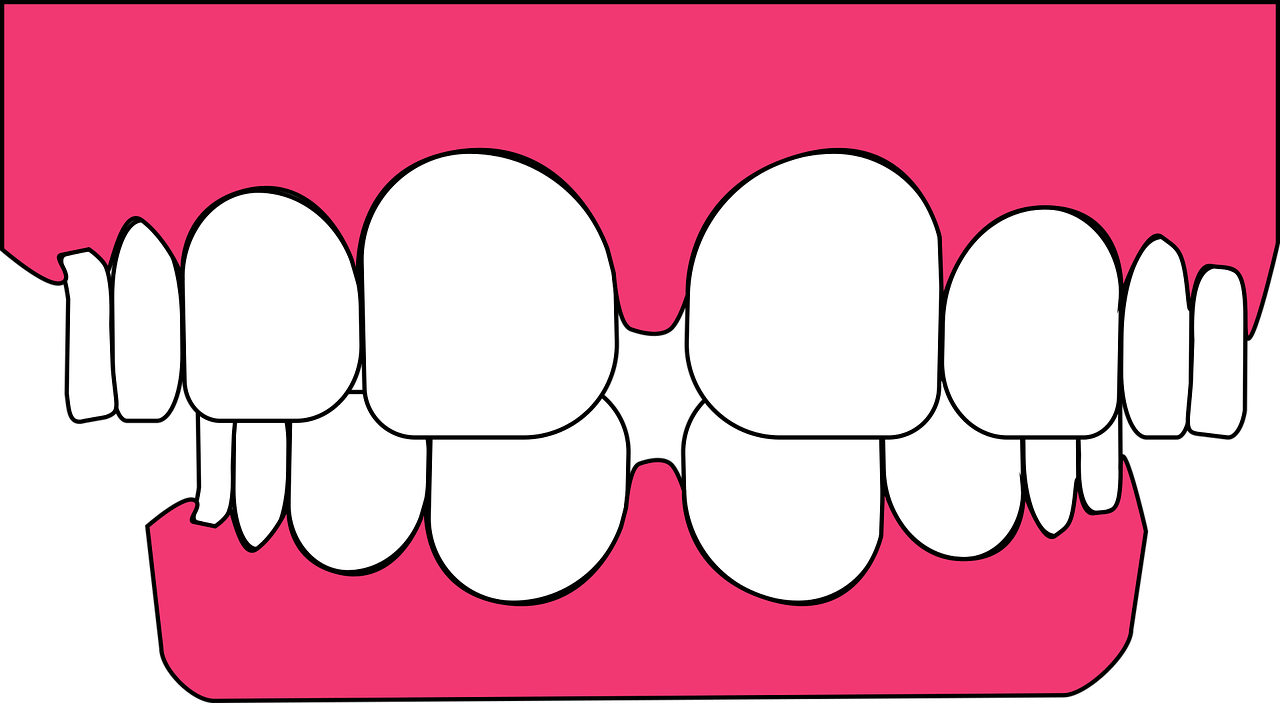 teeth dental gums free photo
