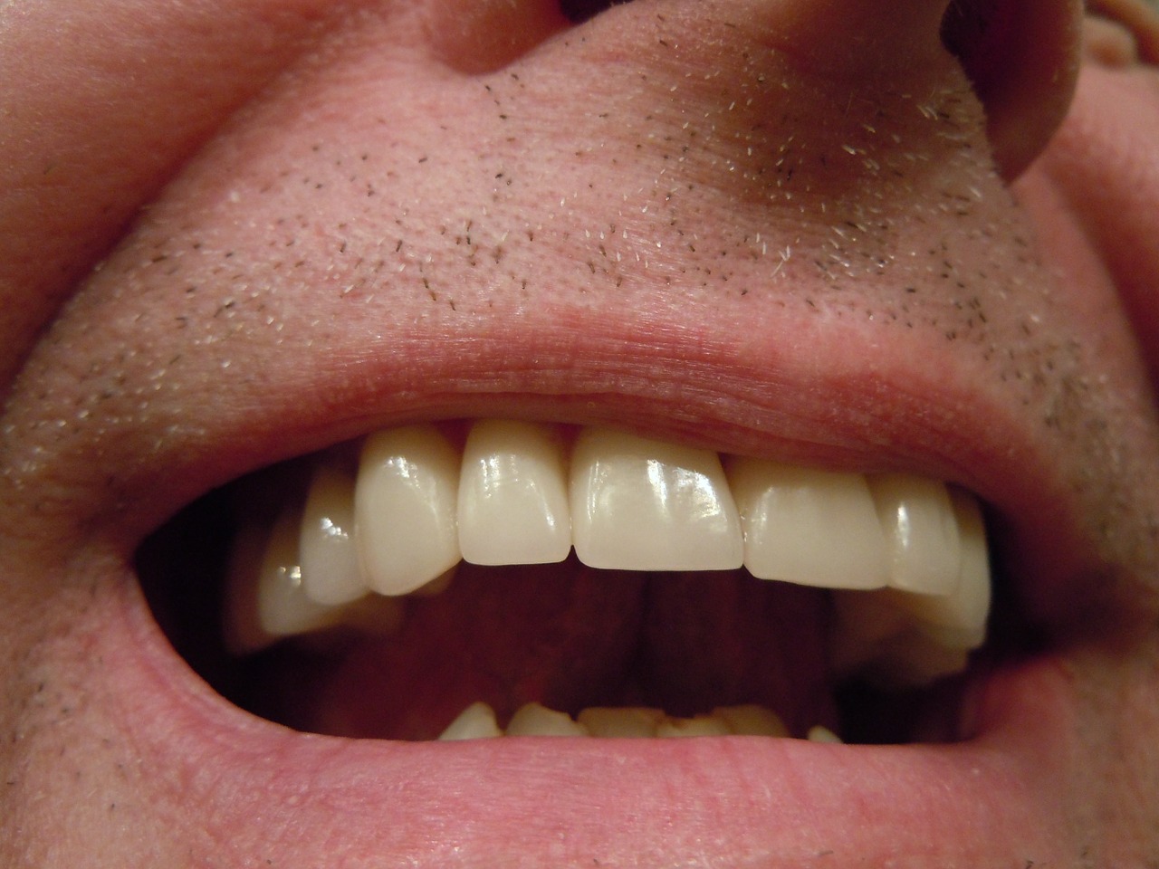 teeth dental tooth free photo
