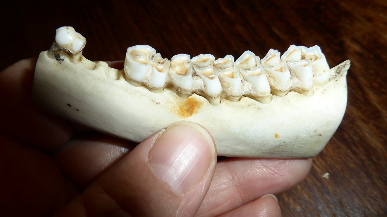 teeth tooth dental caries free photo
