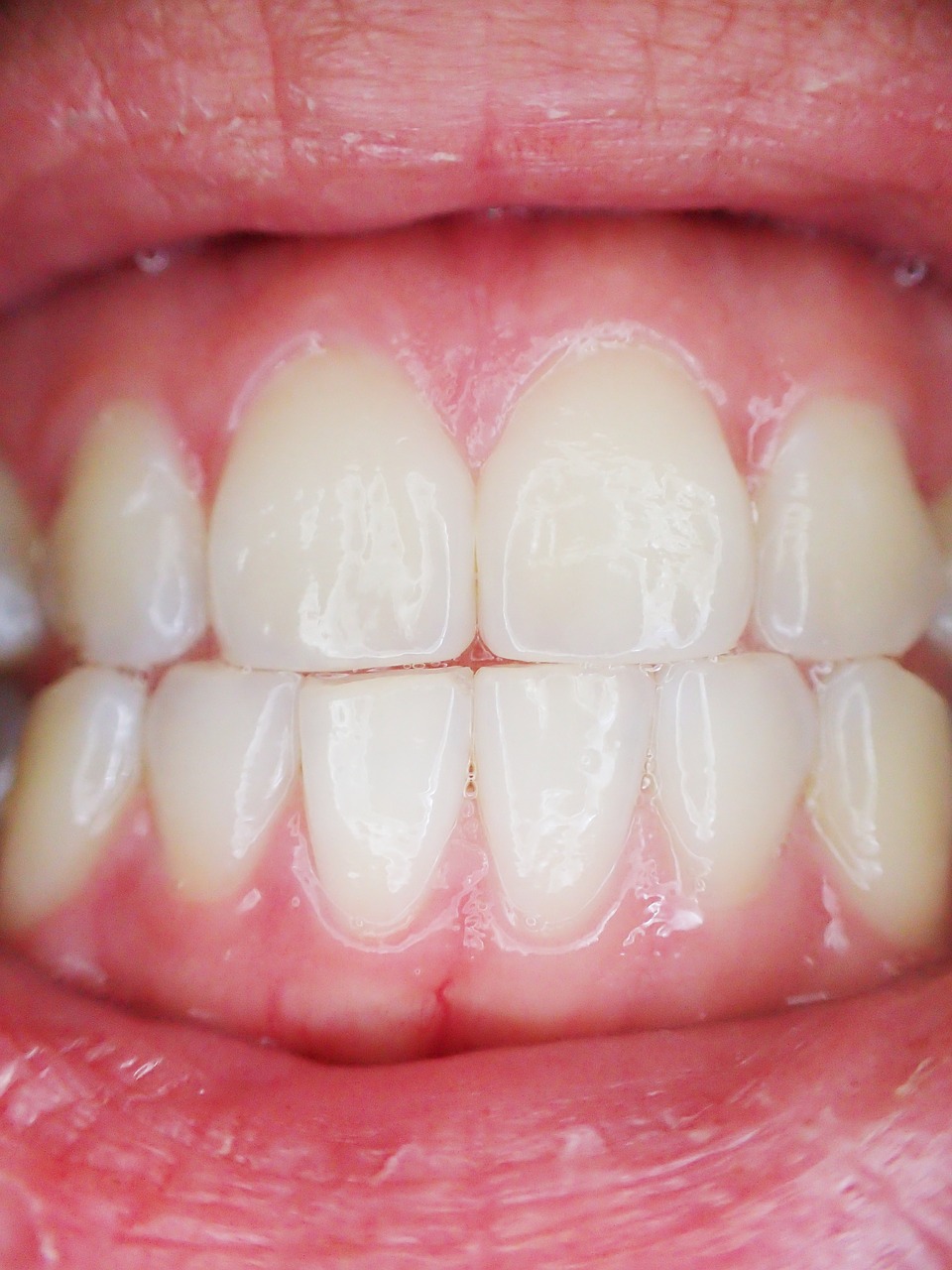 teeth mouth dental free photo