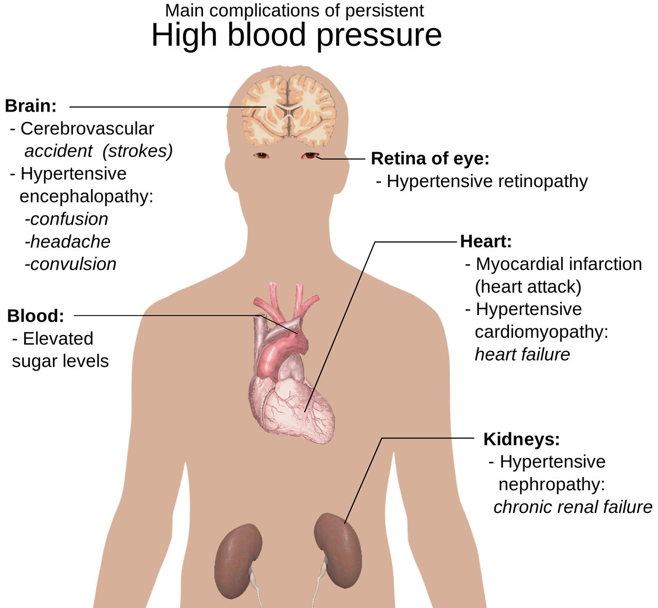 anatomy of the human body big picture hypertension free photo